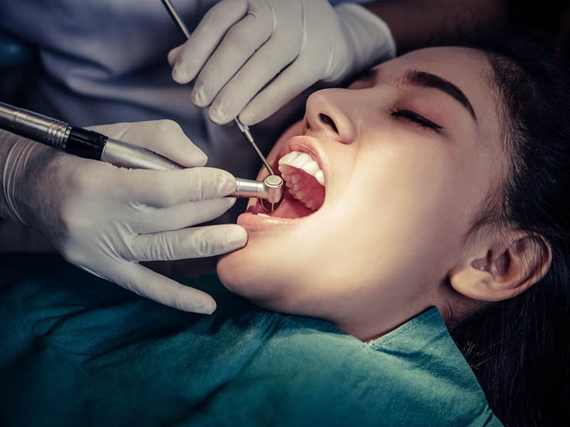 Root canal treatment in Rawalpindi at Aamir Dental Care